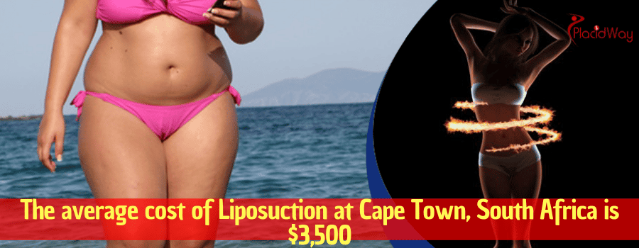 The average cost of Liposuction at Cape Town, South Africa is $3,500